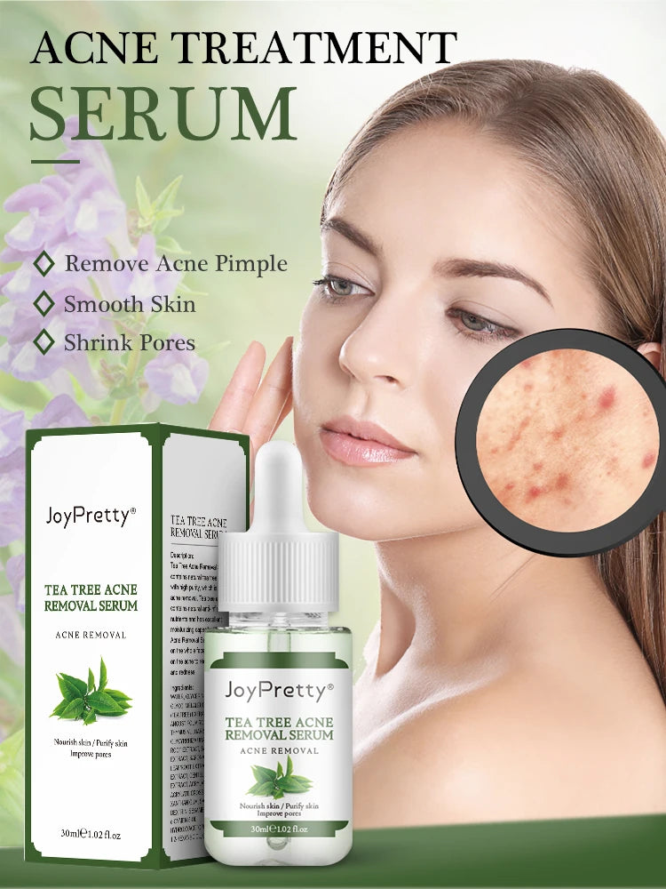 Acne Treatment Face Cream