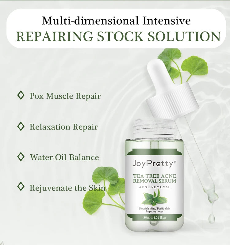 Acne Treatment Face Cream