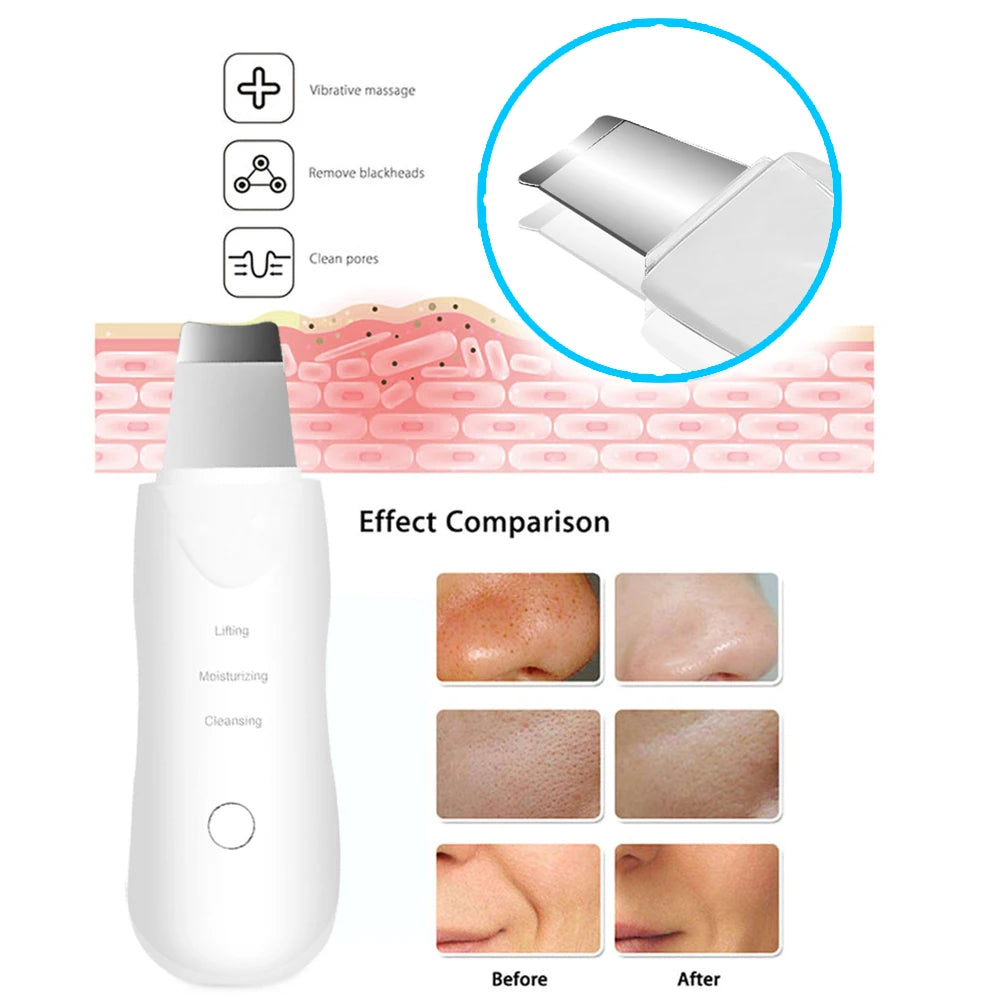 Ultrasonic Skin Scrubber Facial Cleaner