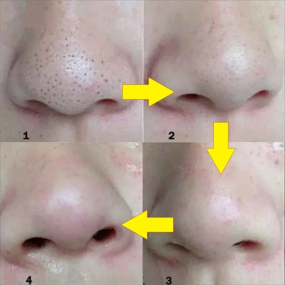 Nose Strips Blackhead Remover Deep Pore Cleanser