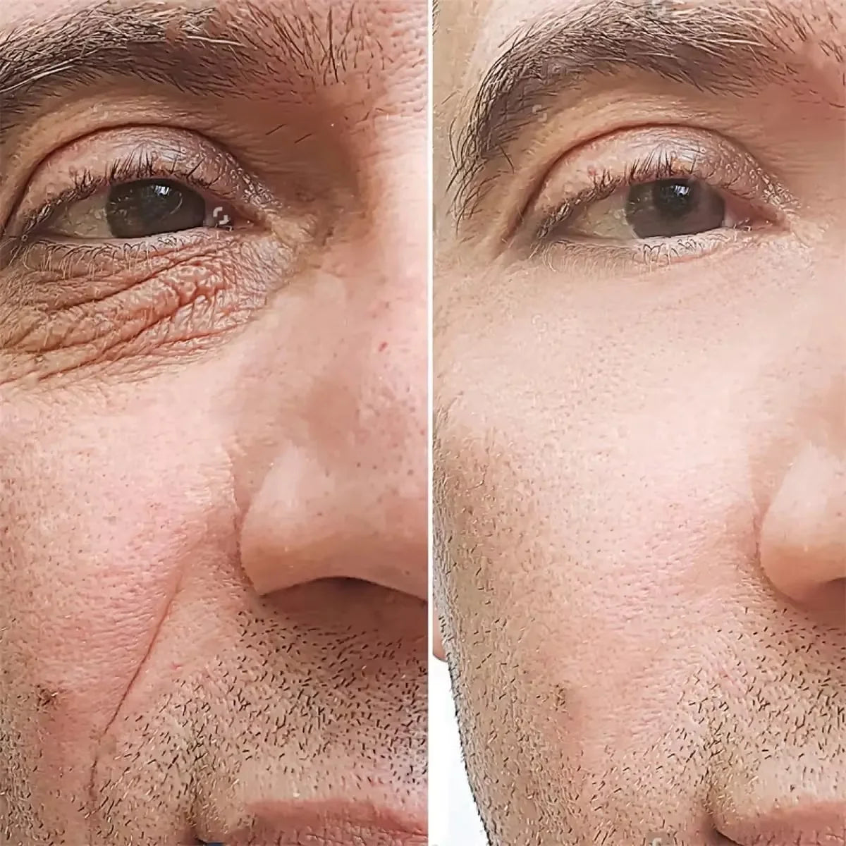 Retinol Anti-wrinkle Cream For Men Collagen Anti-Aging Removal Face