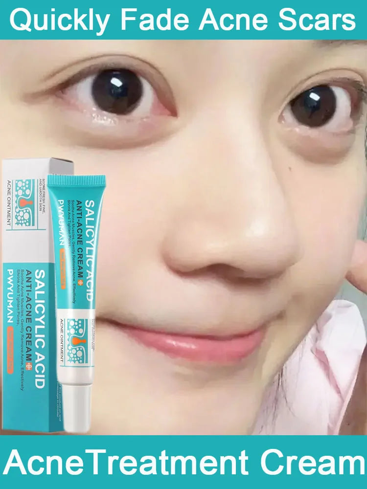 Salicylic Acid Acne Treatment Cream Repair Pimple Spots