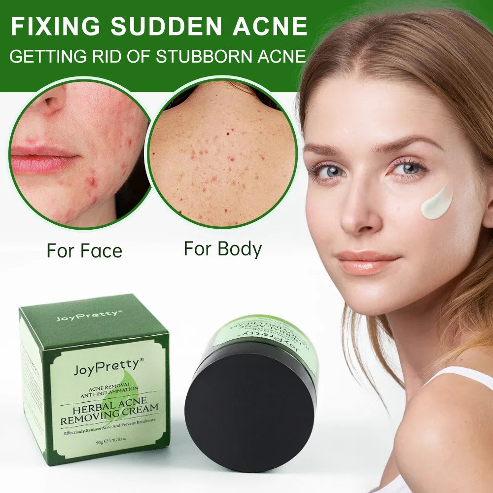 Herbal Acne Face Cream