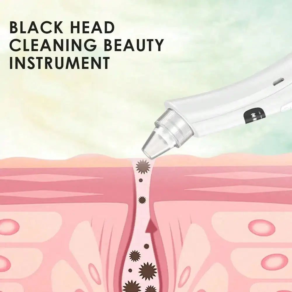 Electric Blackhead Remover Face Vacuum