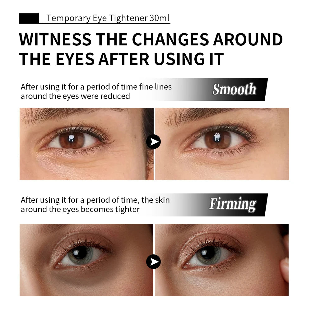 Temporary Eye Tightener Instant FTemporary Eye Tightener