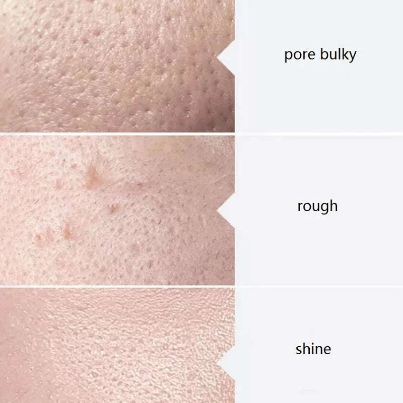 Skincare Face Serum Hydro Facial Aqua Peel Solution 400ml AS1 SA2 AO3 For Machine Skin Deep Cleaning