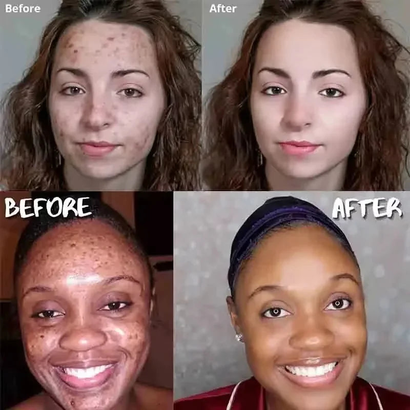 Deep Clean Whitening Soap