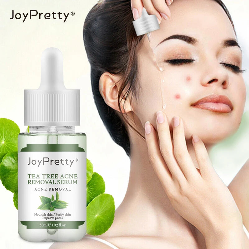 JoyPretty Herbal Skin Care Set Acne Face Cream Tea Tree Serum