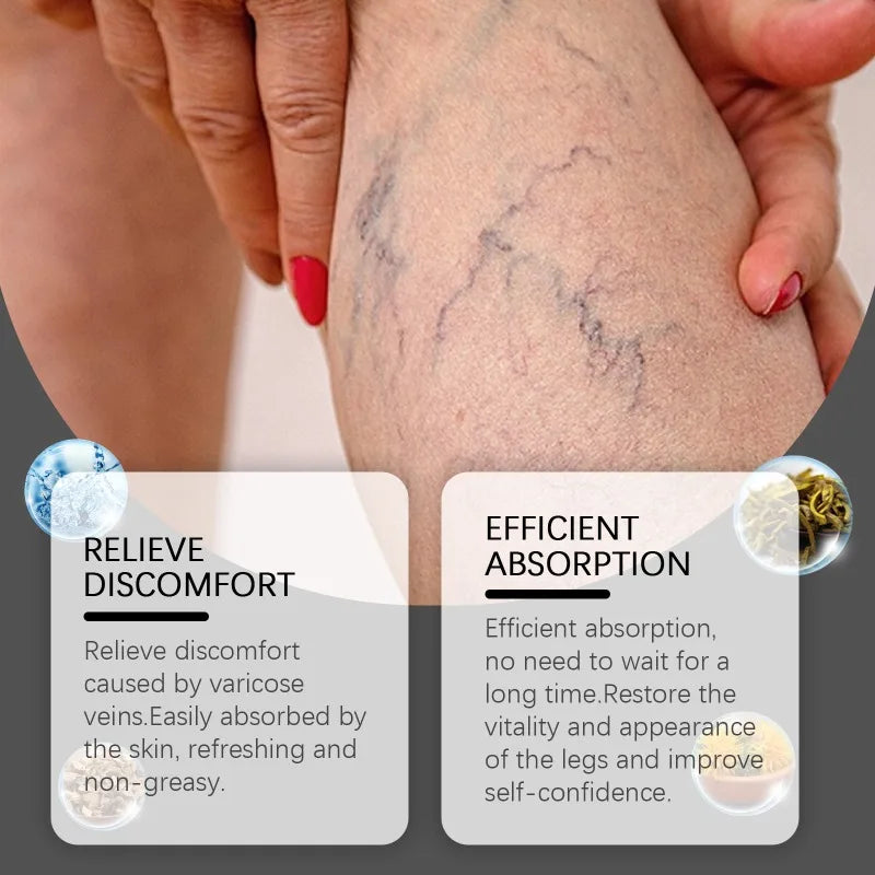 Varicose Veins Relief Cream Gentle Relief of Leg Discomfort Daily Massage Promote Blood Circulation External Use Leg Care Cream