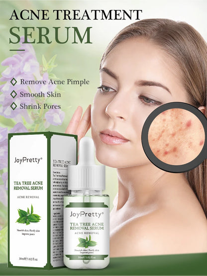 Acne Treatment Face Cream