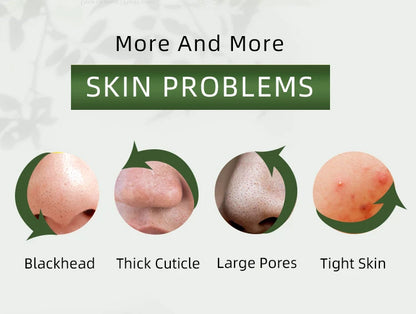 Acne Treatment Face Cream