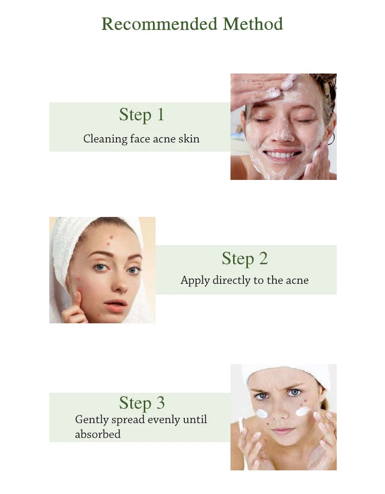 Herbal Acne Cream Oil Control