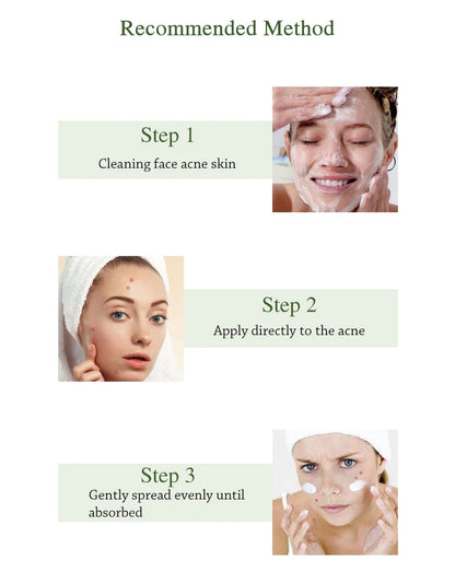 Herbal Acne Cream Oil Control