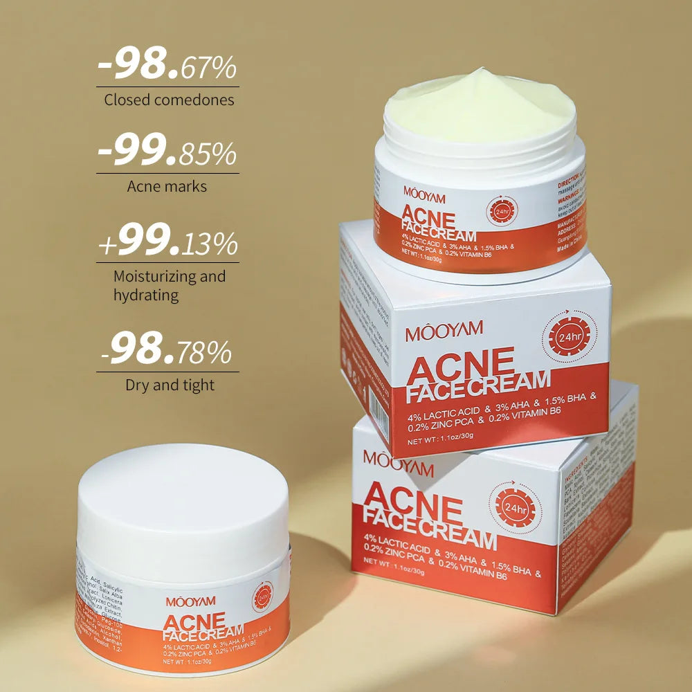 Acne Treatment Cream Anti Acne Face Cream Pimple Removal Spots