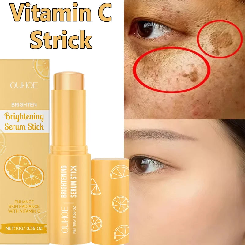 Vitamin C Whitening Freckles Serum Stick Remove Melasma Dark Spots