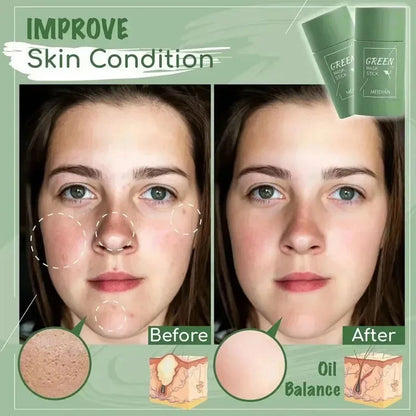Green Tea Remove Blackhead Solid Mask Dispel Acne Blemish Cleansing