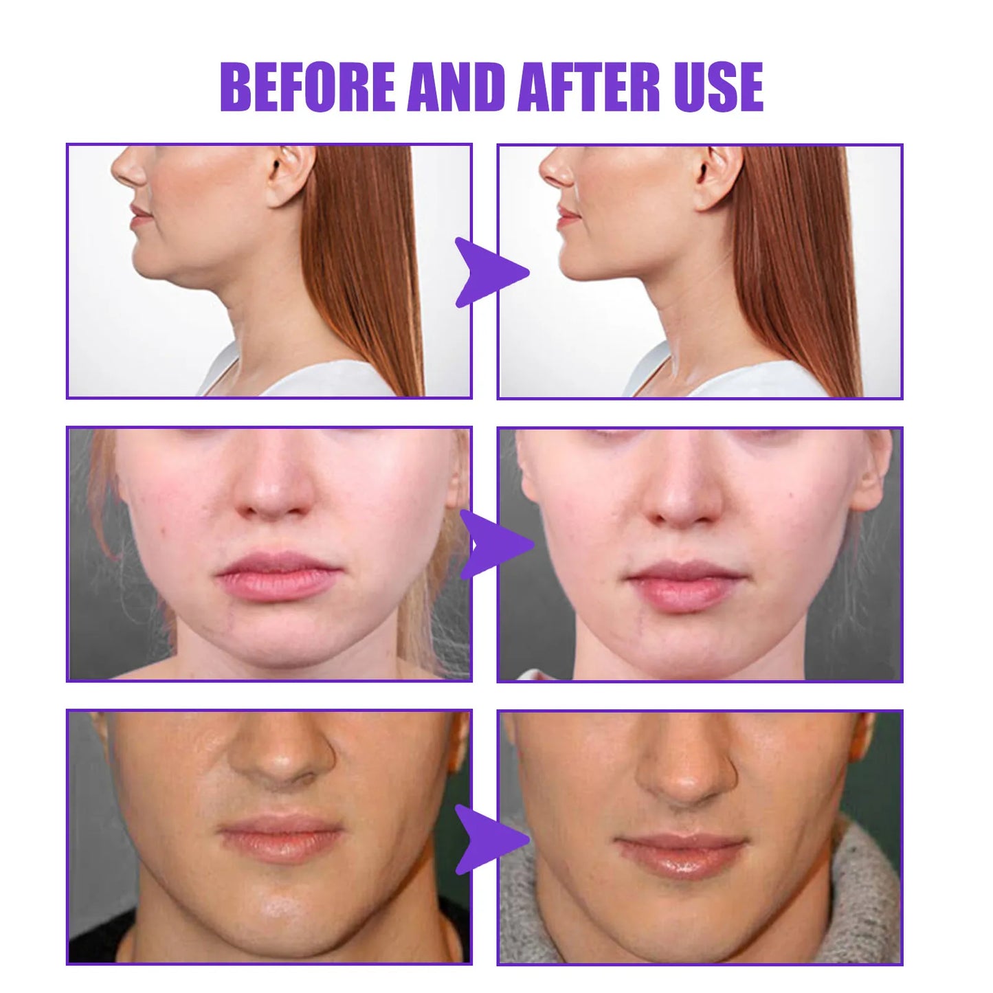 V-Shape Slimming Cream Tighten Mandibular Line Double Chin Lift