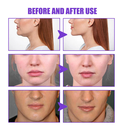 V-Shape Slimming Cream Tighten Mandibular Line Double Chin Lift