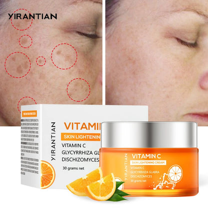 1988 Serum Vitamin C Brightening Cream Fade Melasma Dark Spot