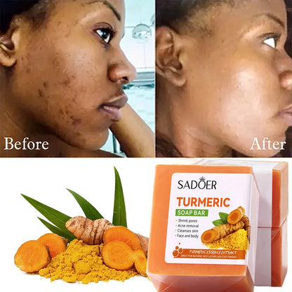 Kojic Acid Soap