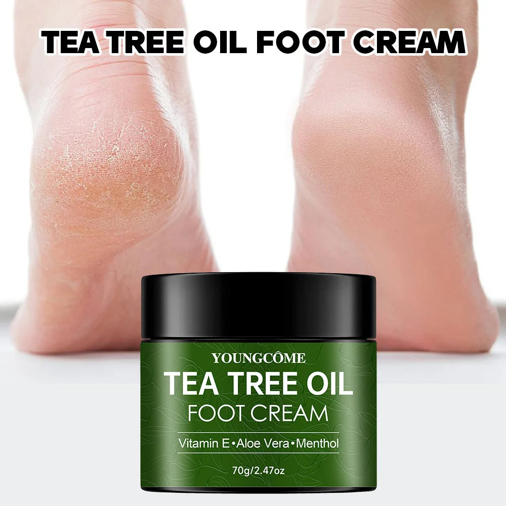 Tea Tree Foot Cream Heel Cracking Repair Products Exfoliation Dead Skin
