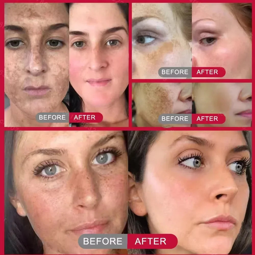 Vitamin C Whitening Freckles Serum Stick Remove Melasma Dark Spots