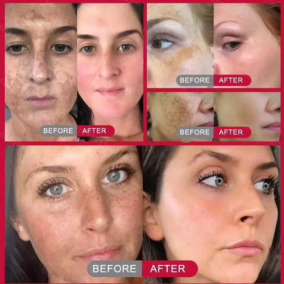 Vitamin C Whitening Freckles Serum Stick Remove Melasma Dark Spots
