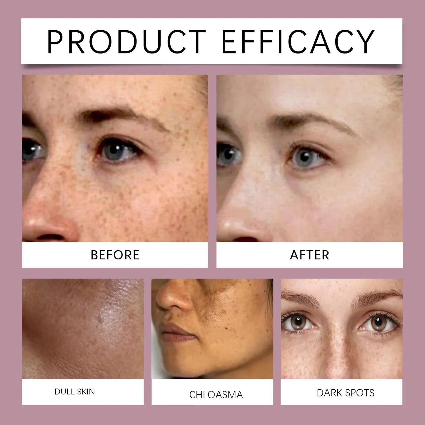 Vitamin C Whitening Freckles Serum Stick Remove Melasma Dark Spots