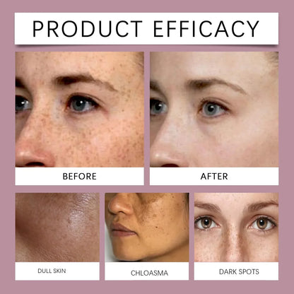 Vitamin C Whitening Freckles Serum Stick Remove Melasma Dark Spots