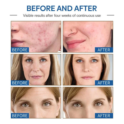 Magic Anti Wrinkle Face Cream Instant Lifting Firming Anti-Aging