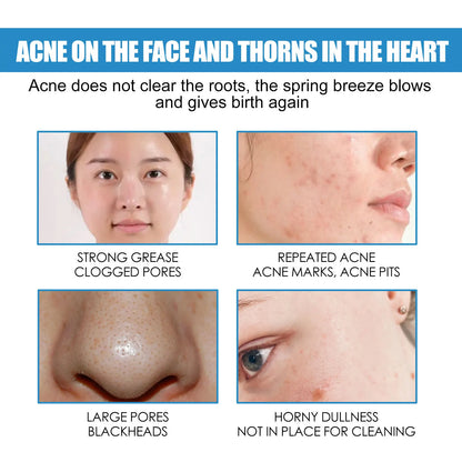 Centella Asiatica Repair Cream For Moisturizer Boost Skin Metabolism