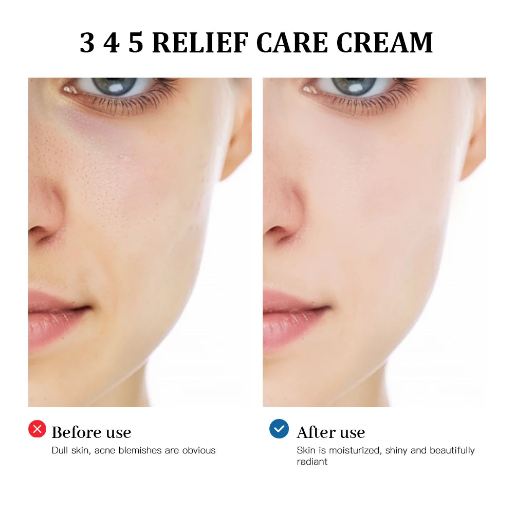 345 Relief Cream solution to skin problems Anti-sugar