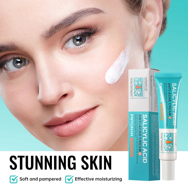 Salicylic Acid Acne Treatment Cream Repair Pimple Spots