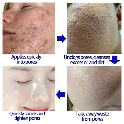 Pore Shrinking Cream Salicylic Acid Cream
