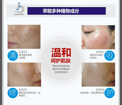 Oil Control Cleanser Serum Cream