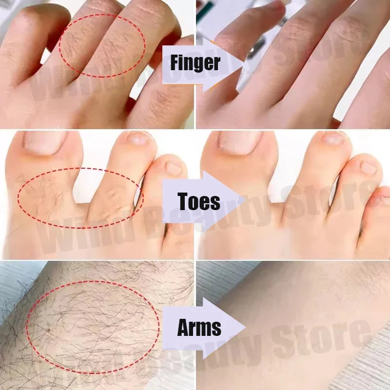 Painless Hair Removal Creams Fast Gentle Removal Skin Care