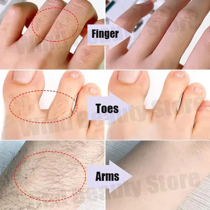 Painless Hair Removal Creams Fast Gentle Removal Skin Care