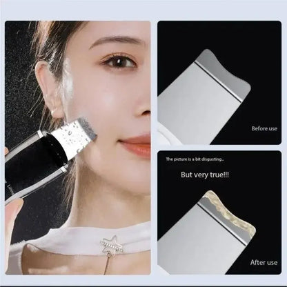 Electric Blackhead Remover Pore Cleaner