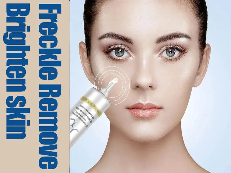 Freckle Removing Cream Blemish Reduces Chloasma Age Spots