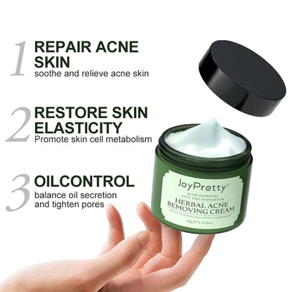 Herbal Acne Cream Oil Control