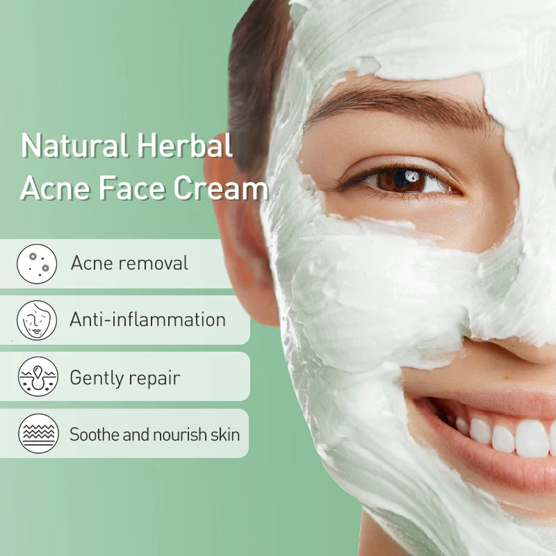 JoyPretty Herbal Skin Care Set Acne Face Cream Tea Tree Serum