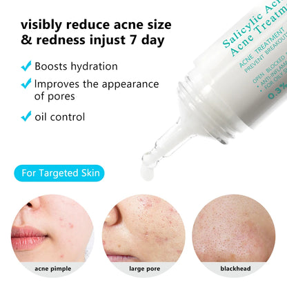 AUQUEST Salicylic Acid Acne Face Cream Pore Blackhead Removal