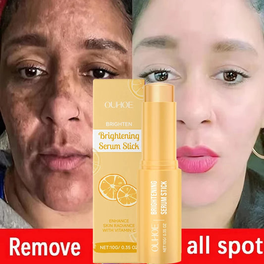 Vitamin C Whitening Freckles Serum Stick Remove Melasma Dark Spots