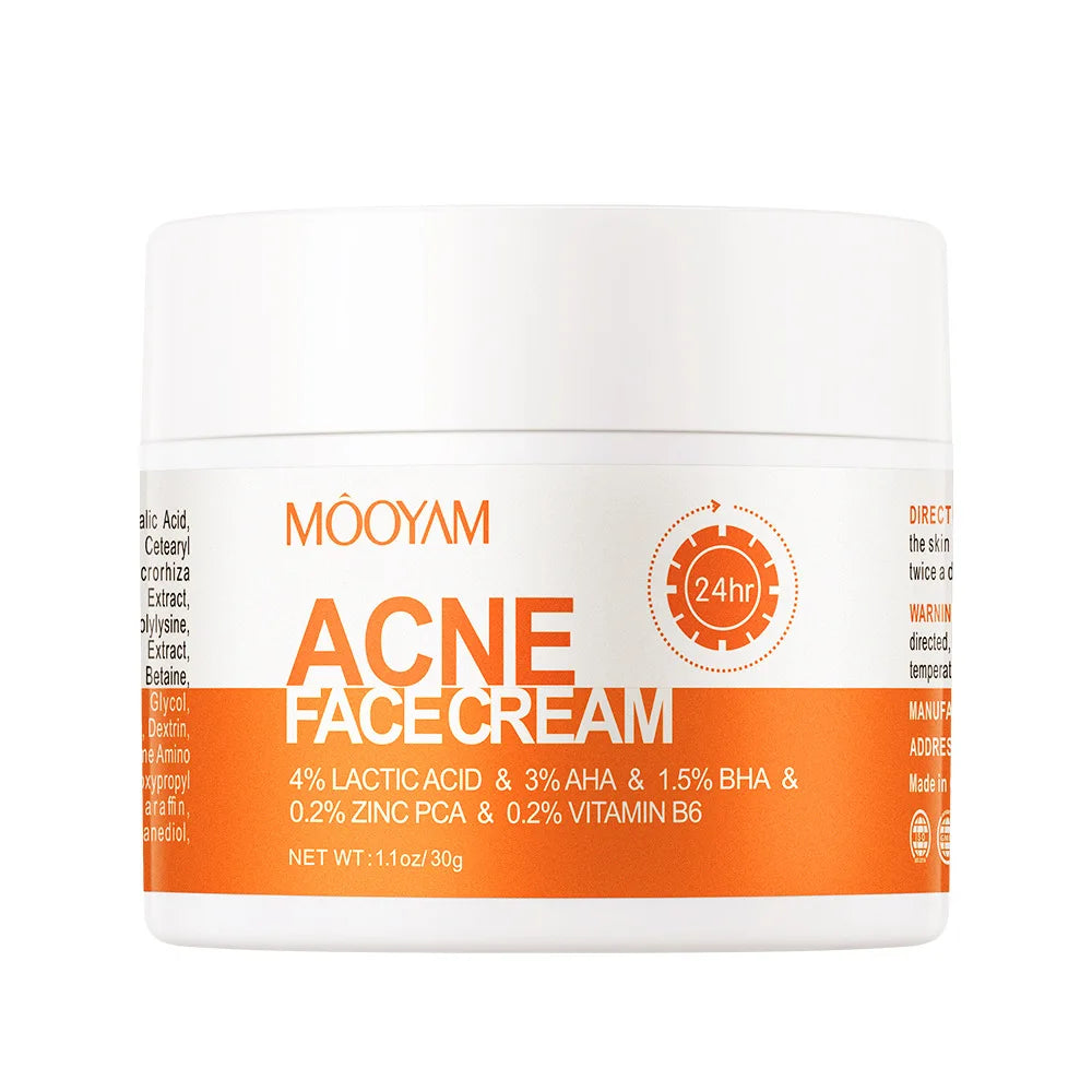 Acne Treatment Cream Anti Acne Face Cream Pimple Removal Spots