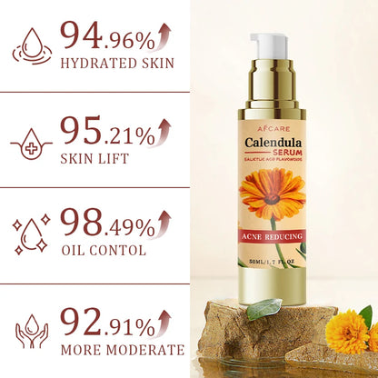 Calendula Face Cream Anti-acne Facial Serum Shrink Pores