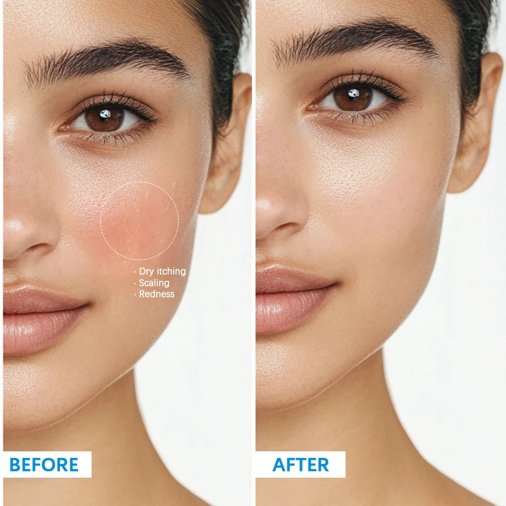 Soothing Hydrating Cream