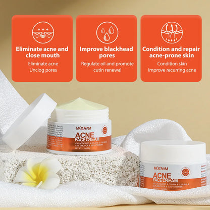 Acne Treatment Cream Anti Acne Face Cream Pimple Removal Spots