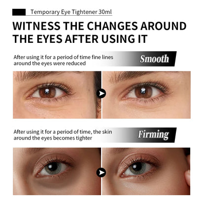 Temporary Eye Tightener Instant FTemporary Eye Tightener