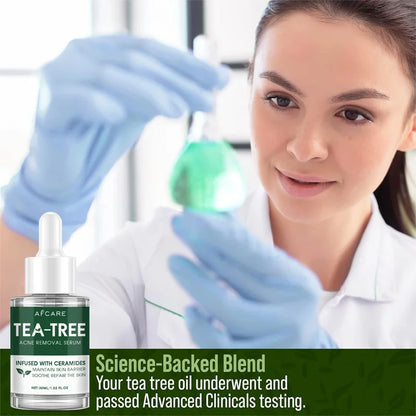 Acne Tea Tree Serum Relief Vegan Non-Sticky Clear Balanced Skin