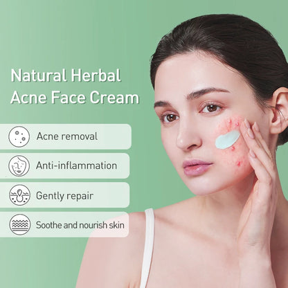 JoyPretty Herbal Skin Care Set Acne Face Cream Tea Tree Serum